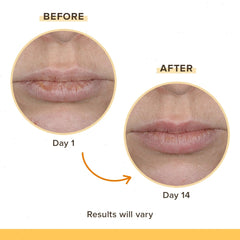 Cooling Eucalyptus Rescue Balm